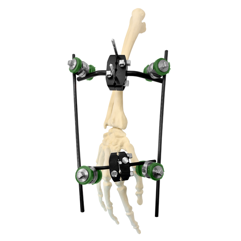ExoFix MRI System (4)